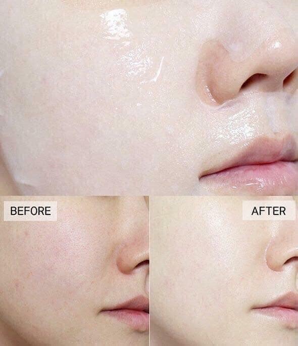 Miếng Lẻ mặt nạ Mediheal Essential Mask Ex 25ml