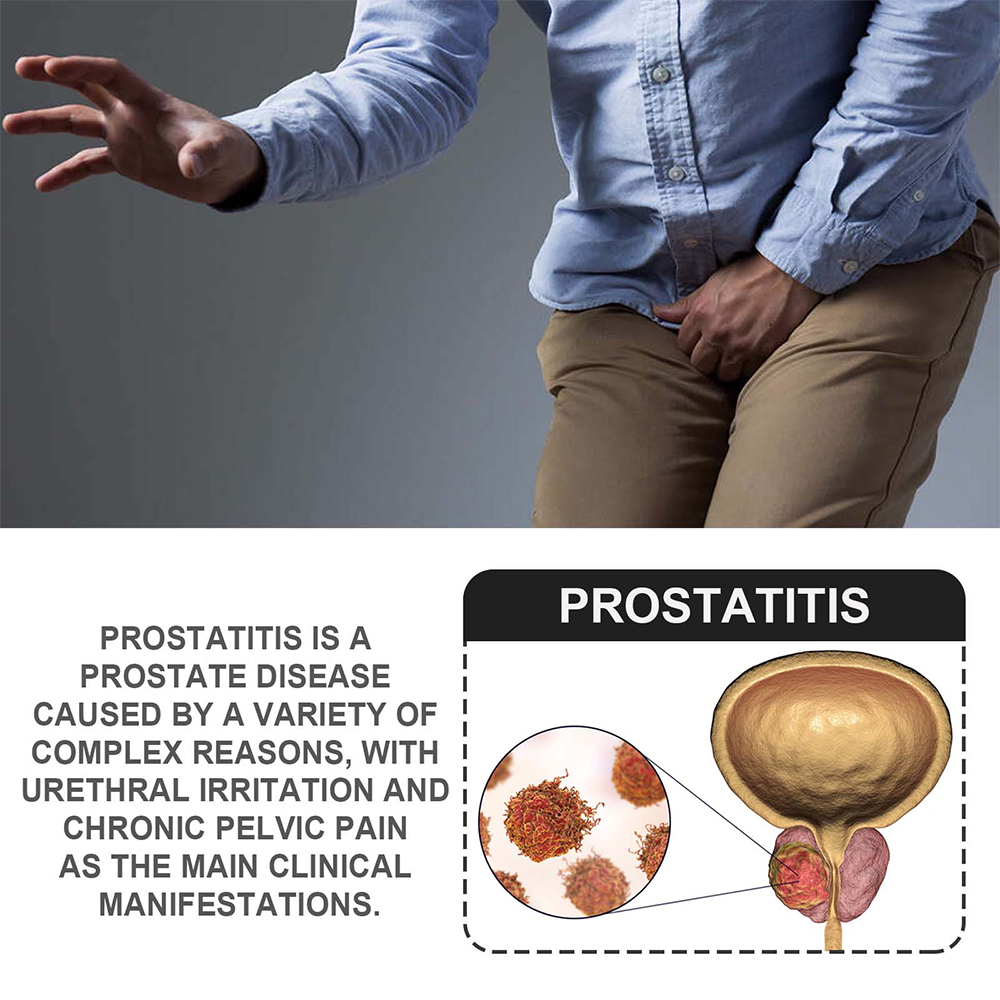 Prostate Button 【Limited Time Only】 Prostatitis Prostate Improves Prostatic Problems ...