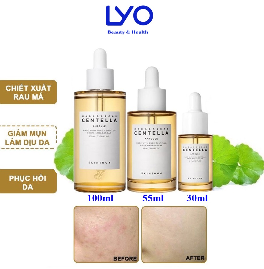 Tinh Chất Rau Má Skin1004 Madagascar Centella Ampoule Lyo Shop