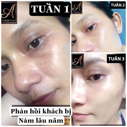 [CHÍNH HÃNG] Kem dưỡng trắng da face pháp a cosmetics -