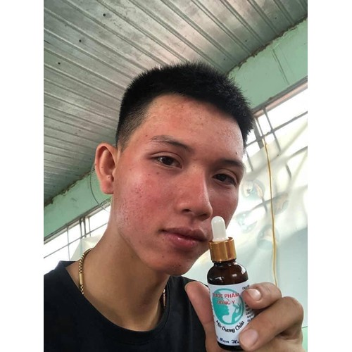 Serum tái tạo da Mộc Dương Châu 30ml
