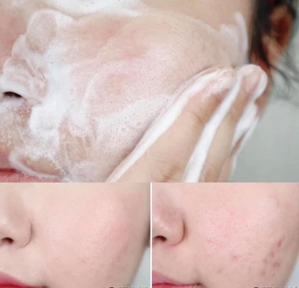 Sữa Rữa Mặt  Skin1004 Madagascar Centella Ampoule Foam