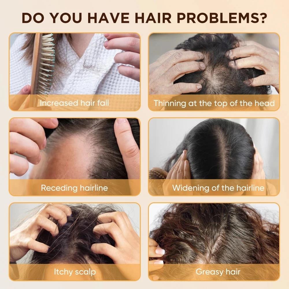 Jiheti%20High%20Quality%20%20EMS%20Vibration%20Scalp%20Massager%20Light%20Therapy%20Head%20Massage%20Infrared%20Therapy%20Treatment%20Vibration%20Massage%20Hairbrush%20Hair%20Anti%20Loss%20-%20Image%206