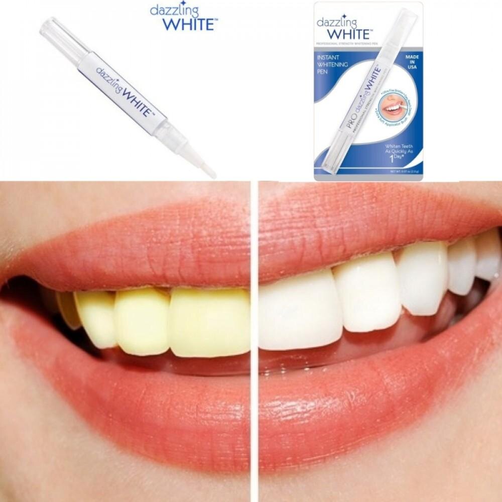 Bút Tẩy Trắng Răng Teeth Whitening Pen (Mẫu mới)