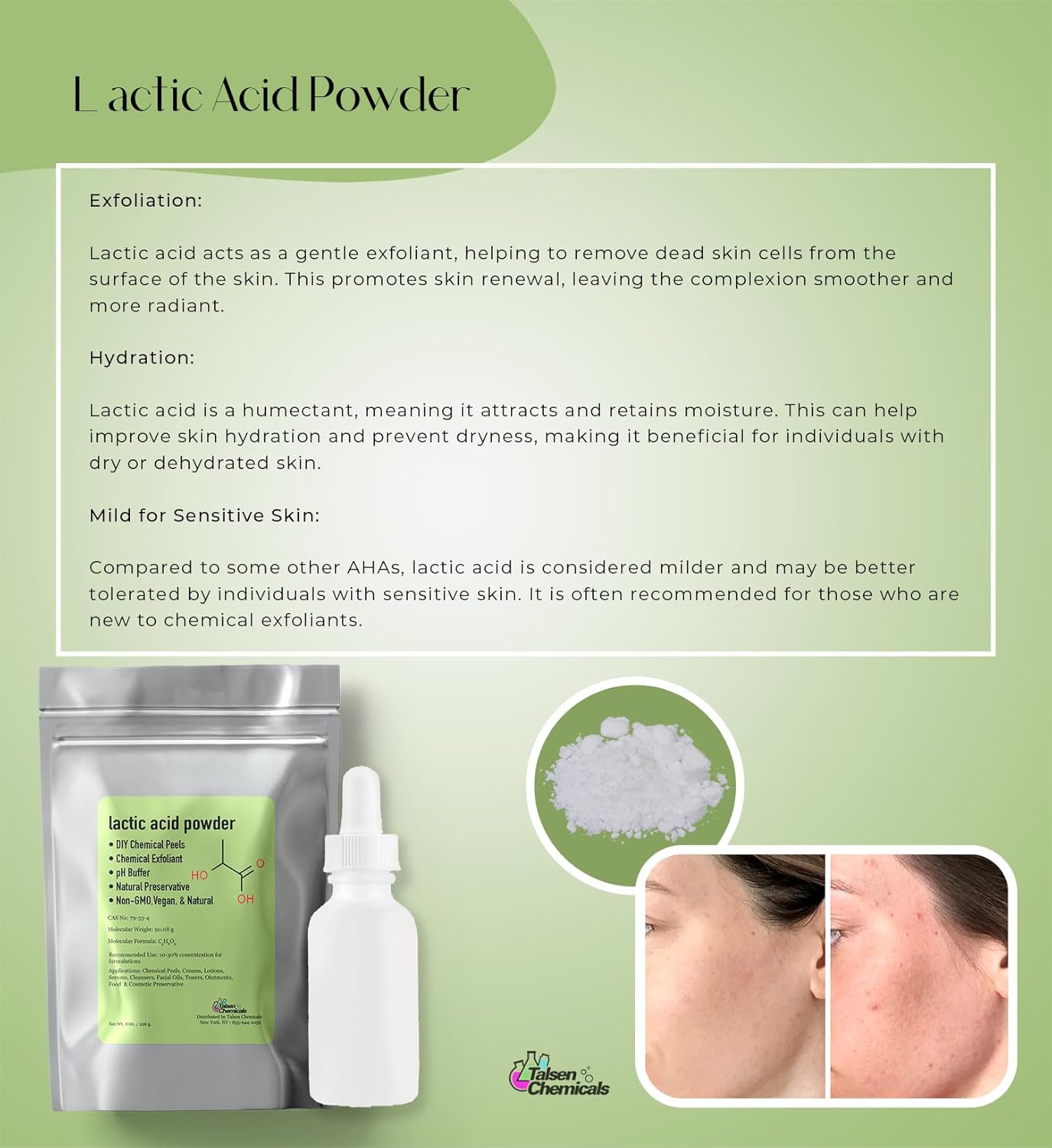 Lactic Acid Powder Lactic Acid Food and Cosmetics Grade DIY Lactic Acid Peel for Skin Moisturizing 4 Ounce. 
