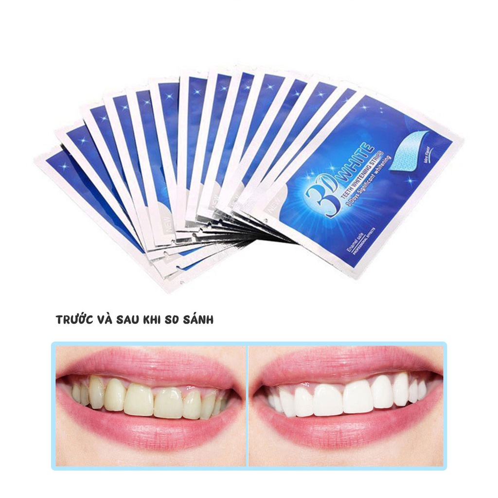 Miếng dán làm trắng răng 3d tiện dụng