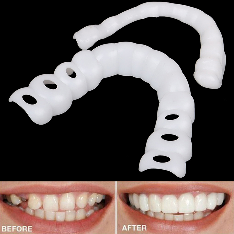 Orthodontic%20Beauty%20Teeth%20Corrector%20Inferior%20Braces%20Tooth%20Retainer%20Tools%20Cleaning%20tools%20GHAN%20-%20Image%205