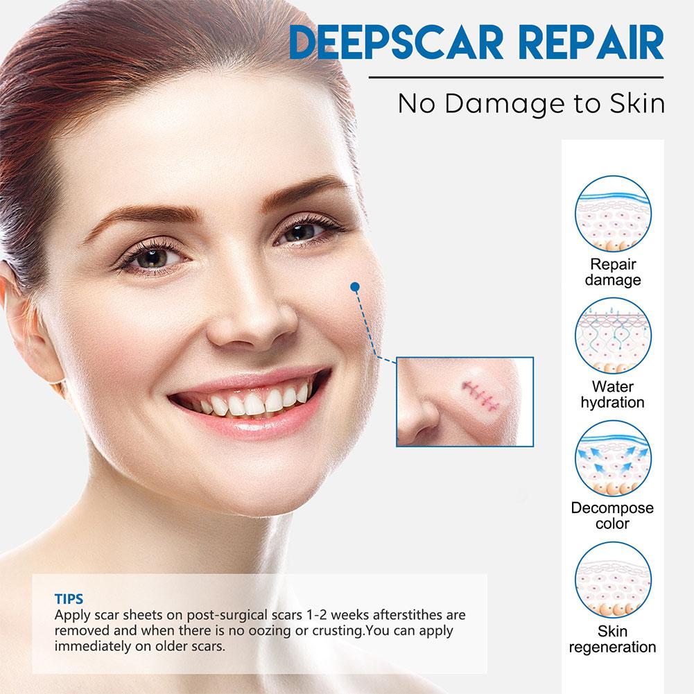 Wenefang%20Fashion%20Efficient%20Silicone%20Scar%20Removal%20Gel%20Tape%20For%20Surgery%20Scar%20Repair%20Sticker%20Sheet%20Therapy%20Patch%20Waterproof%20Skin%20Care%20Patches%20O7B2%20-%20Image%206