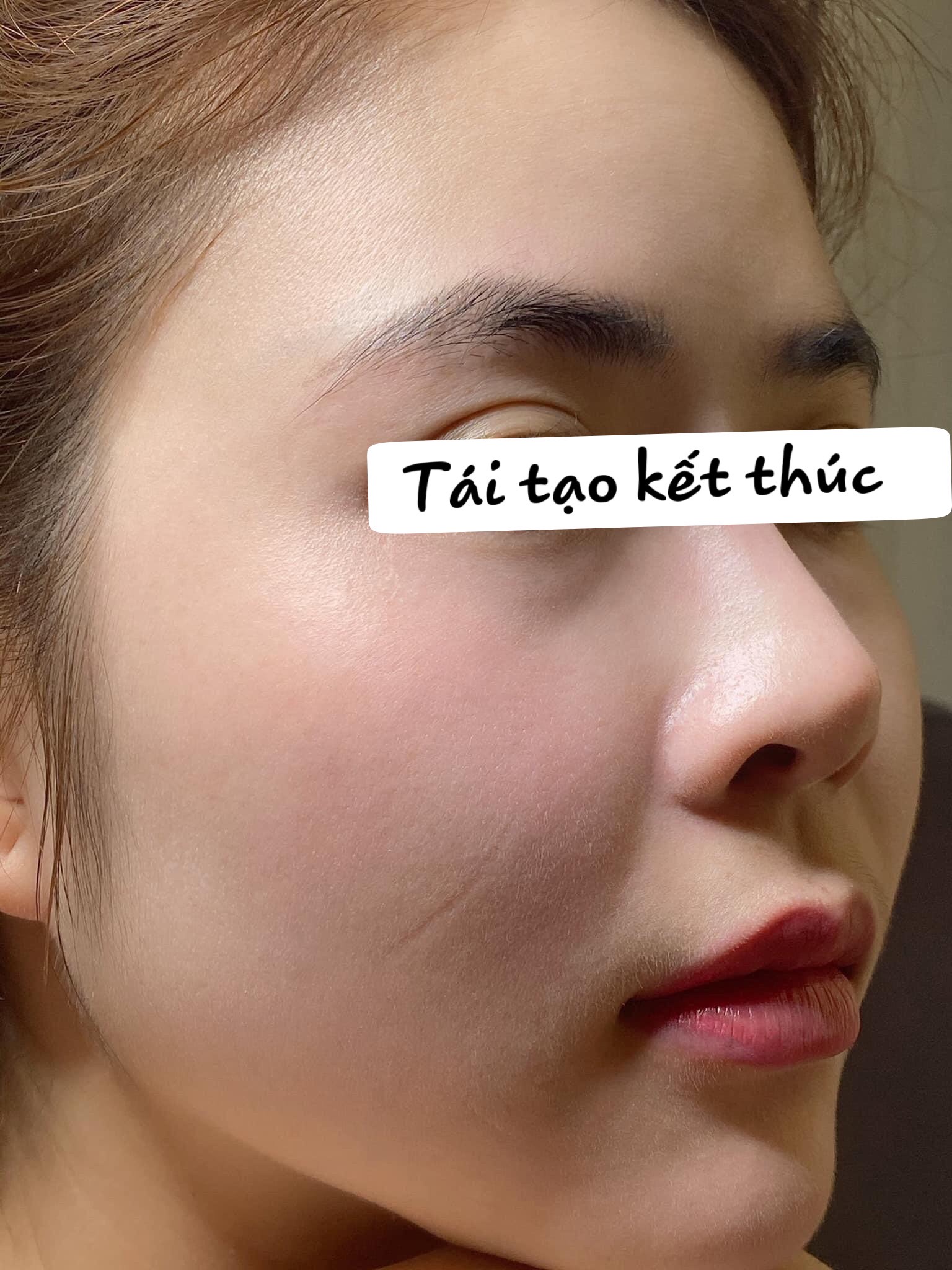 [HCM]Cổ Mộc Lan 50ml