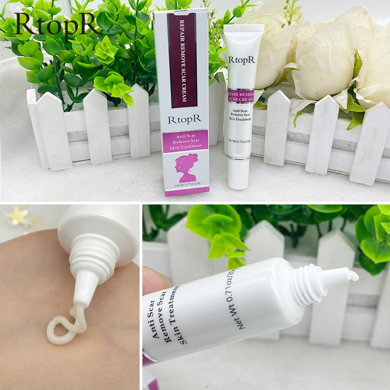rtopr stretch mark cream