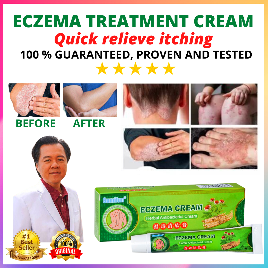 👍 100% ORIGINAL & Effective Eczema Treatment herbal antibacterial cream ...