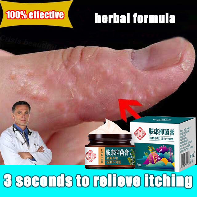 100% Effective Psoriasis Ointment Herbal Anti Itch Cream Psoriasis ...