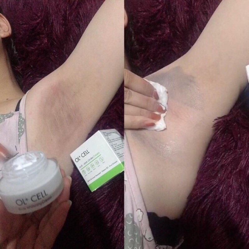 KEM TRỊ THÂM NÁCH, THÂM MÔI, THÂM NHŨ HOA HÀN QUỐC - Ol+Cell