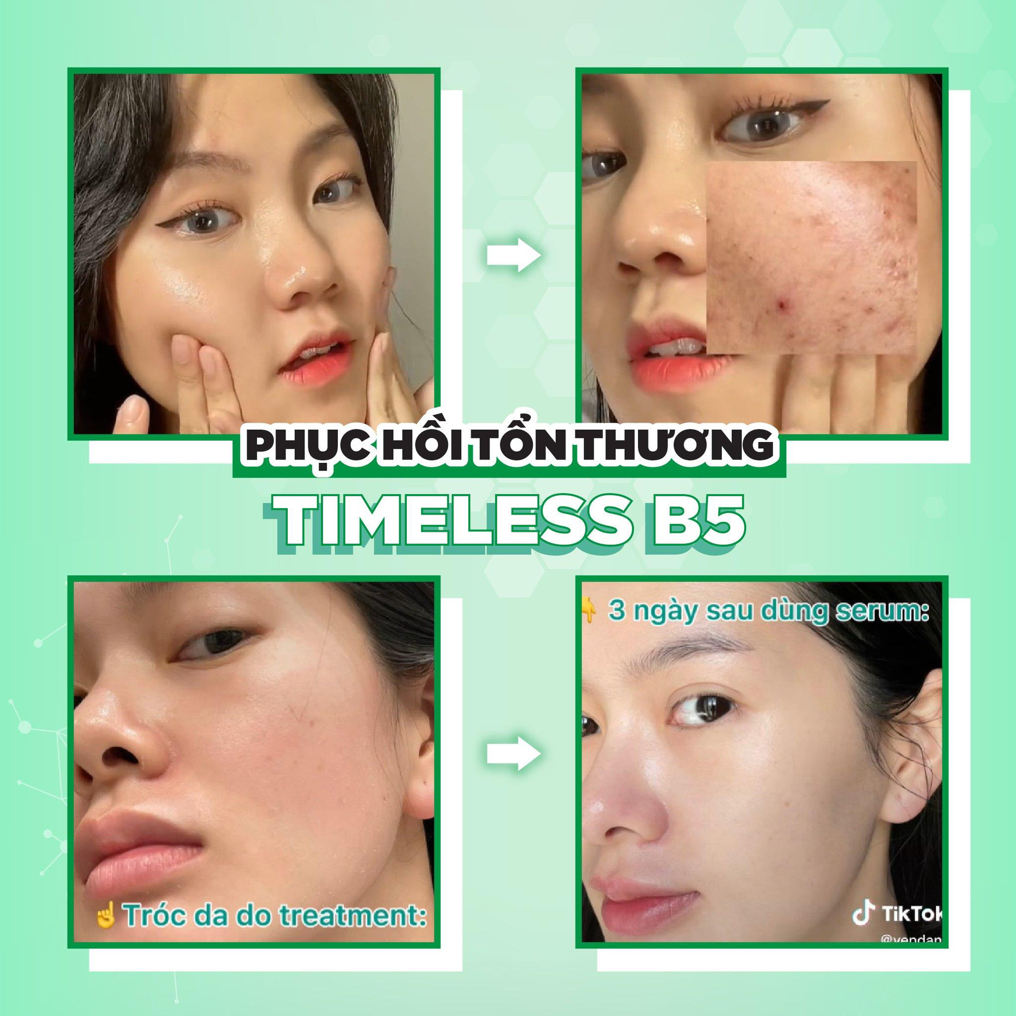 [HCM]Serum tái tạo phục hồi da B5 Timeless 30ml