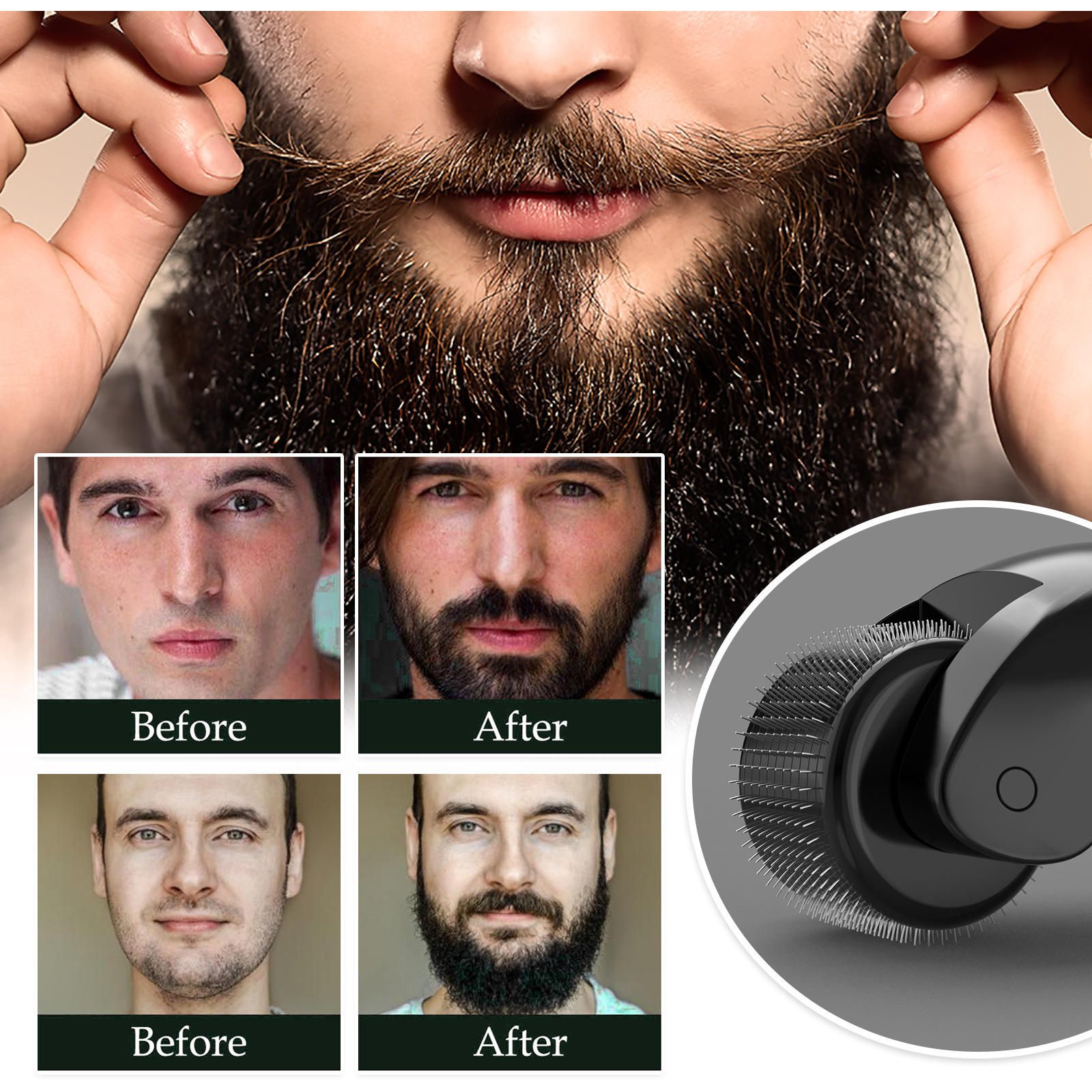 West Month Con Lăn Derma Con Lăn Mọc Râu Cho Nam Con Lăn Vi Kim Con Lăn Phục Hồi Râu Mọc Lại Râu & Tóc Chăm Sóc Mọc Râu (30G)
