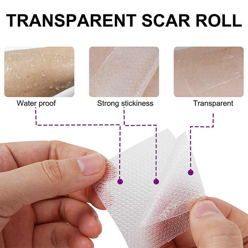 4x15cm%20Scar%20Patches%20Remove%20Silicone%20Gel%20Sheet%20Treatment%20Patch%20Ear%20Correctors%20Burn%20Wounds%20Efficient%20Surgery%20Scar%20Tape%20Skin%20Repair%20BOYUAN%20-%20Image%203