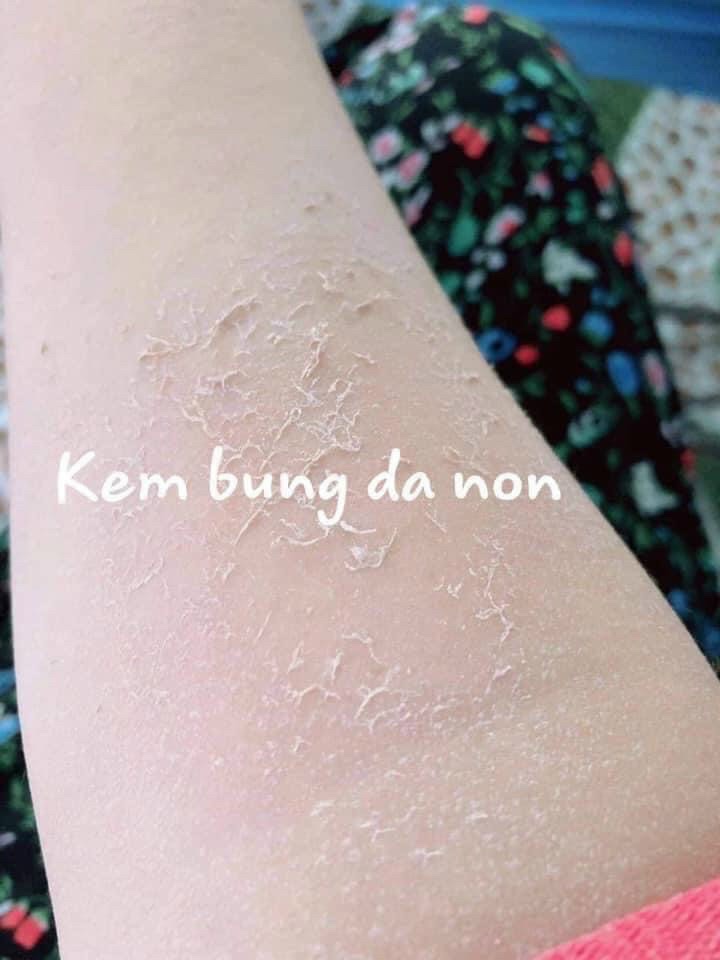 KEM BONG DA TÁI SINH BODY