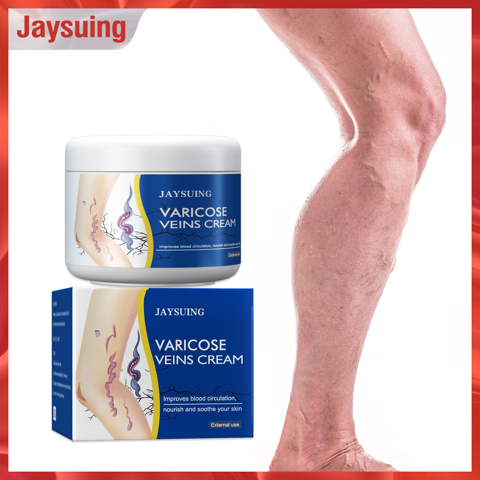 Pain Relief Cream For Varicose Veins At Gene Courtney Blog