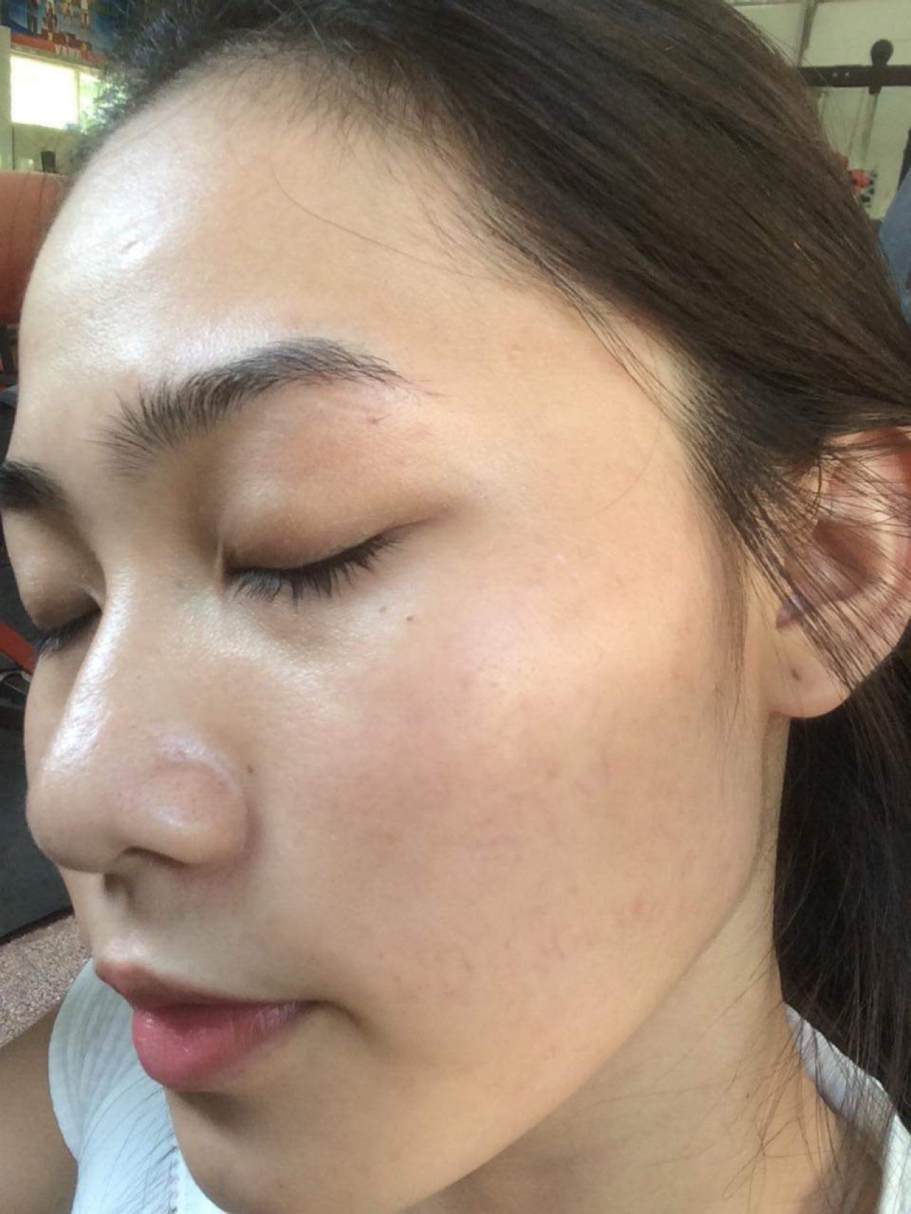 Renew skin Cổ Mộc Lan 20ml