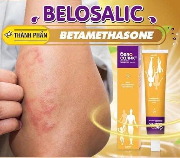 { CHÍNH HÃNG } Kem bôi da cơ địa Belosalic Nga