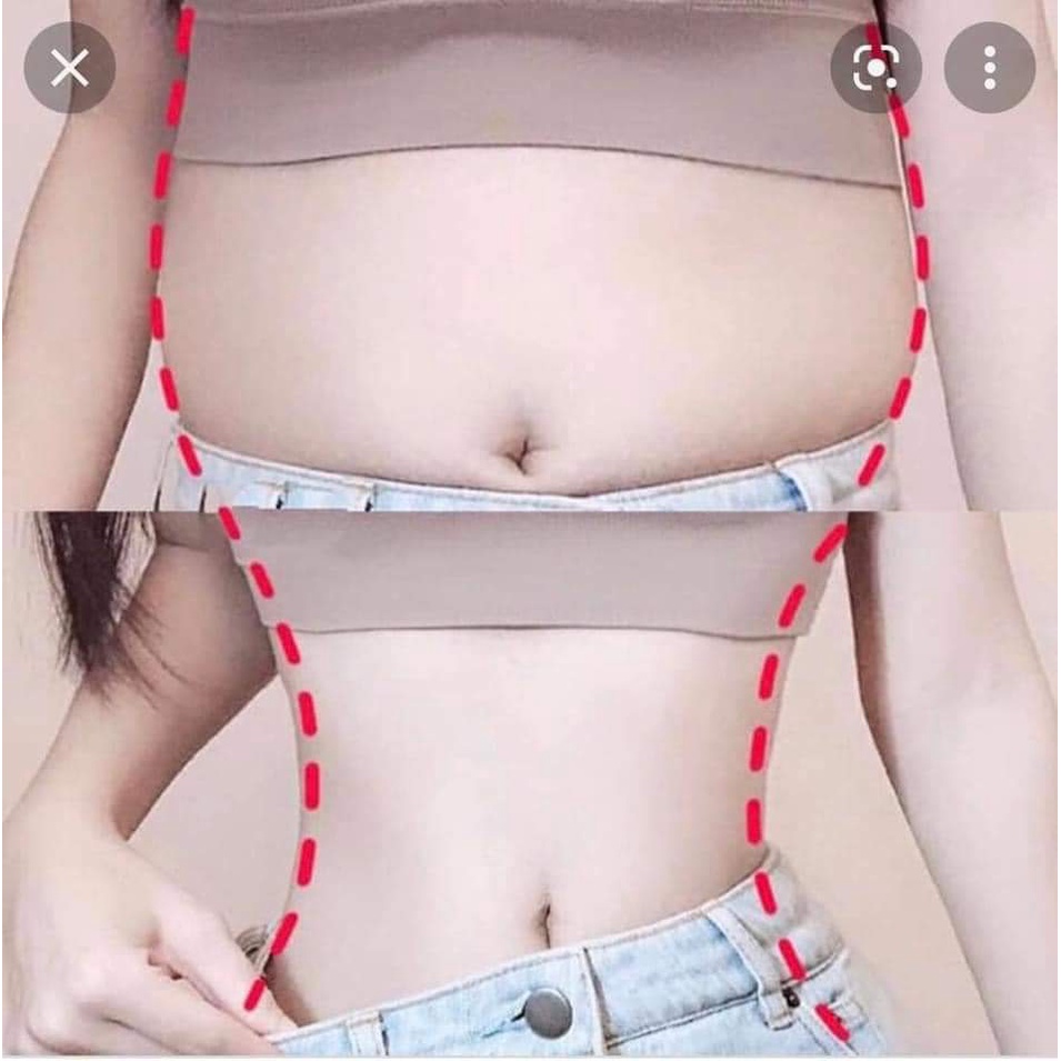 KEM TAN MỠ BỤNG MISSHA HOT