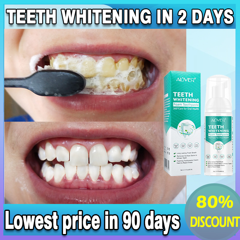 【WorryFree】ALIVER Cleaning Teeth Whitening Mousse Foam Toothpaste Oral