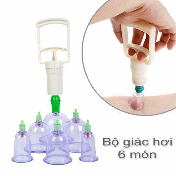 Bộ giác hơi 12 món không dùng lửa cao cấp