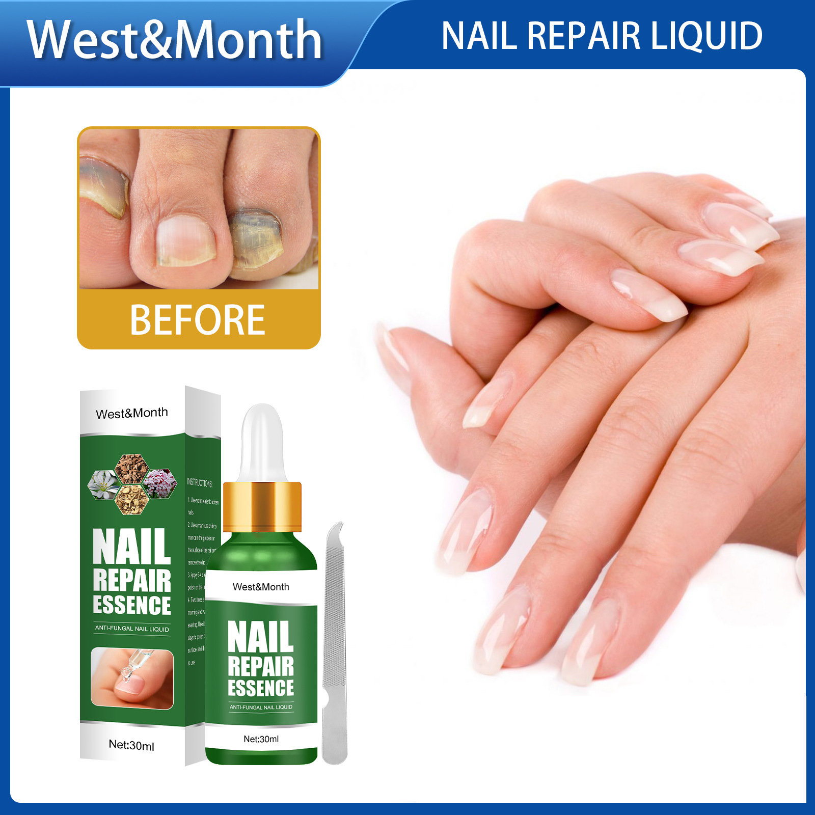 West Month Nail Repair Liquid Nail Care Treatment Nail Treatment Care ...