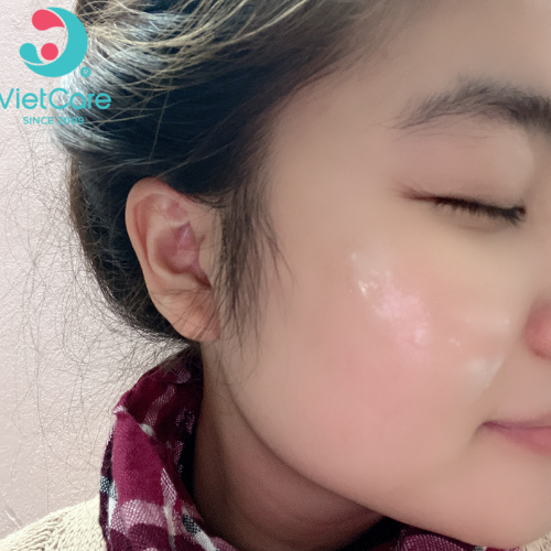 Tẩy da chết đu đủ VIETCARE