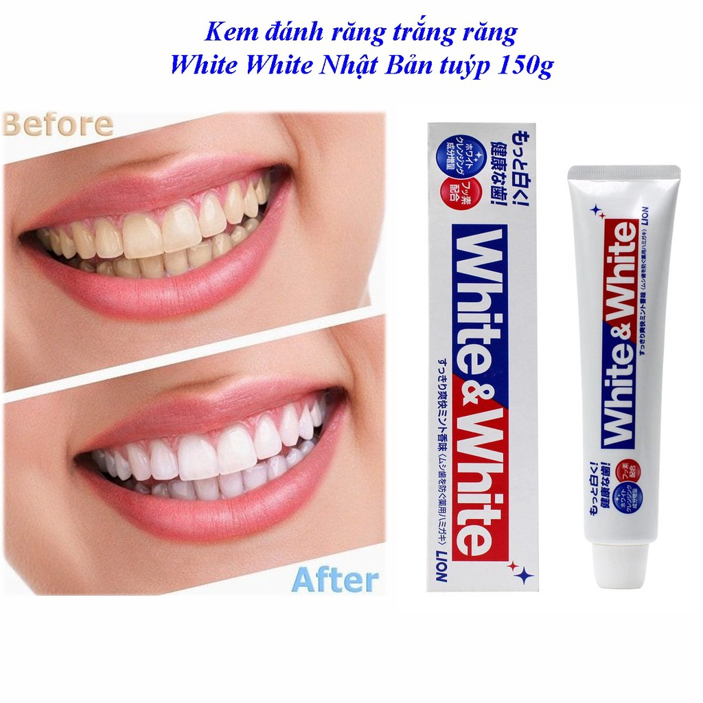Kem Đánh Răng White And White Lion 150g Nhật Bản