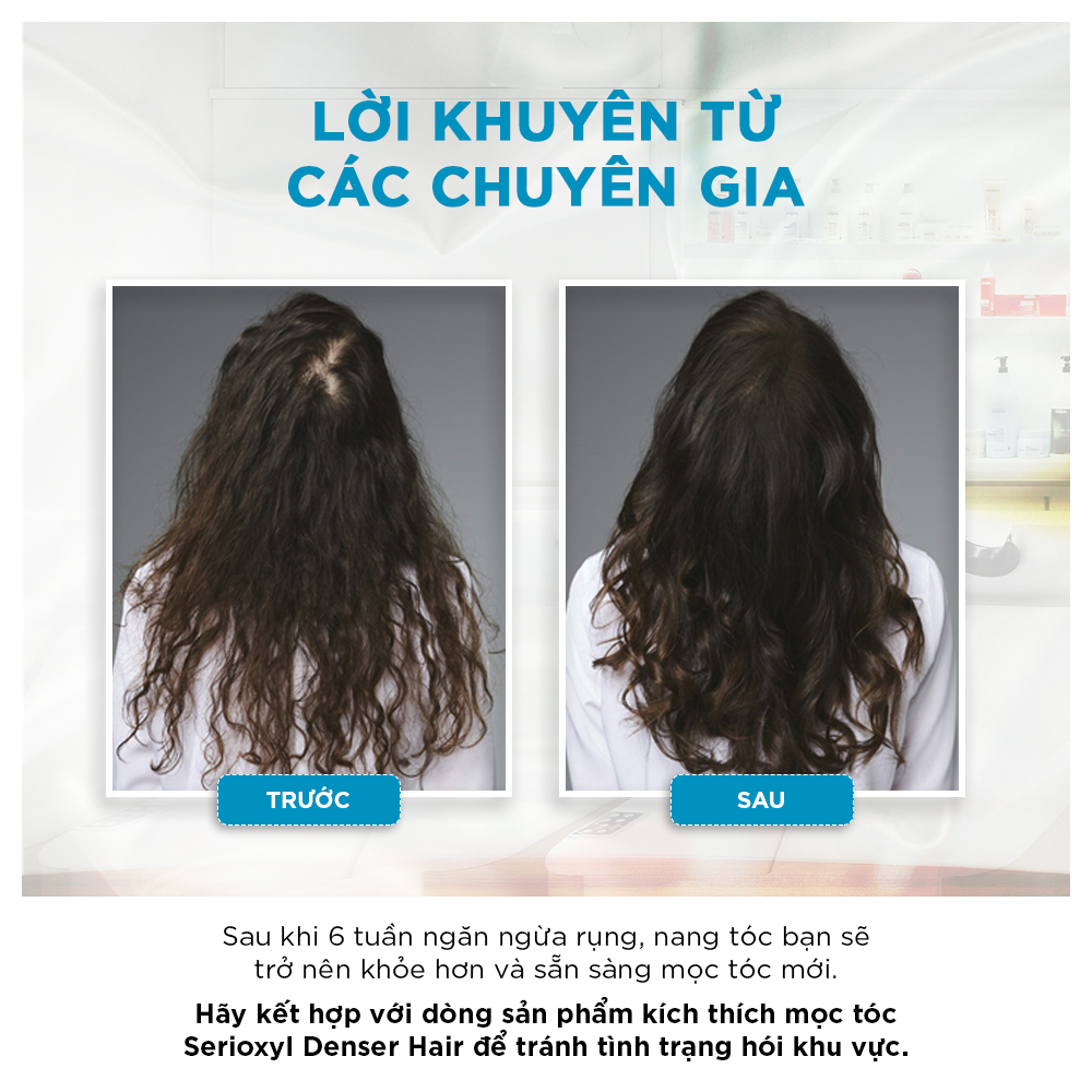 Tinh chất chống rụng tóc LOREAL AMINEXIL 10 x 6ml