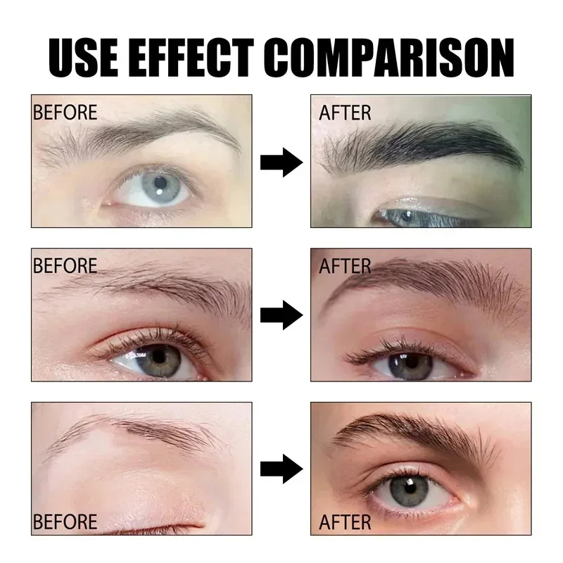 Fast Eyebrow Growth Serum Eyelash Hair Growth Anti Hairs Loss Product Prevent Baldness Fuller Thicker Lengthening Eyebrow Makeup. 