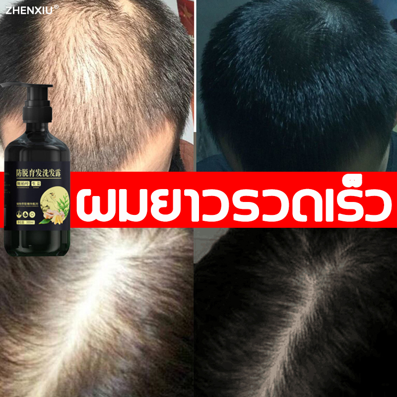 ZHENXIU แชมพูแก้ผมร่วง 300ml ยาสระผม แชมพูขิง แชมพูสระผม ยาสระผมแก้ร่วง