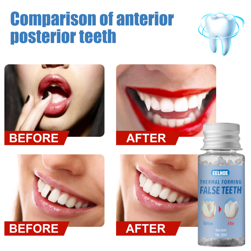 MerMer store EELHOE temporary tooth repair teeth Temporary Restorative Denture Filling Solid Gel Thermoforming Denture Restorative Denture Gel Resin false teeth denture teeth repair pasta