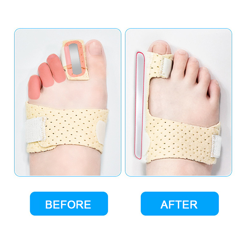 HOT 1PC Adjustable Hammer Toe Straightener Corrector For Metatarsalgia Claw Toe Mallet Toe Pain Relief Splint Foot Compression Wrap. 
