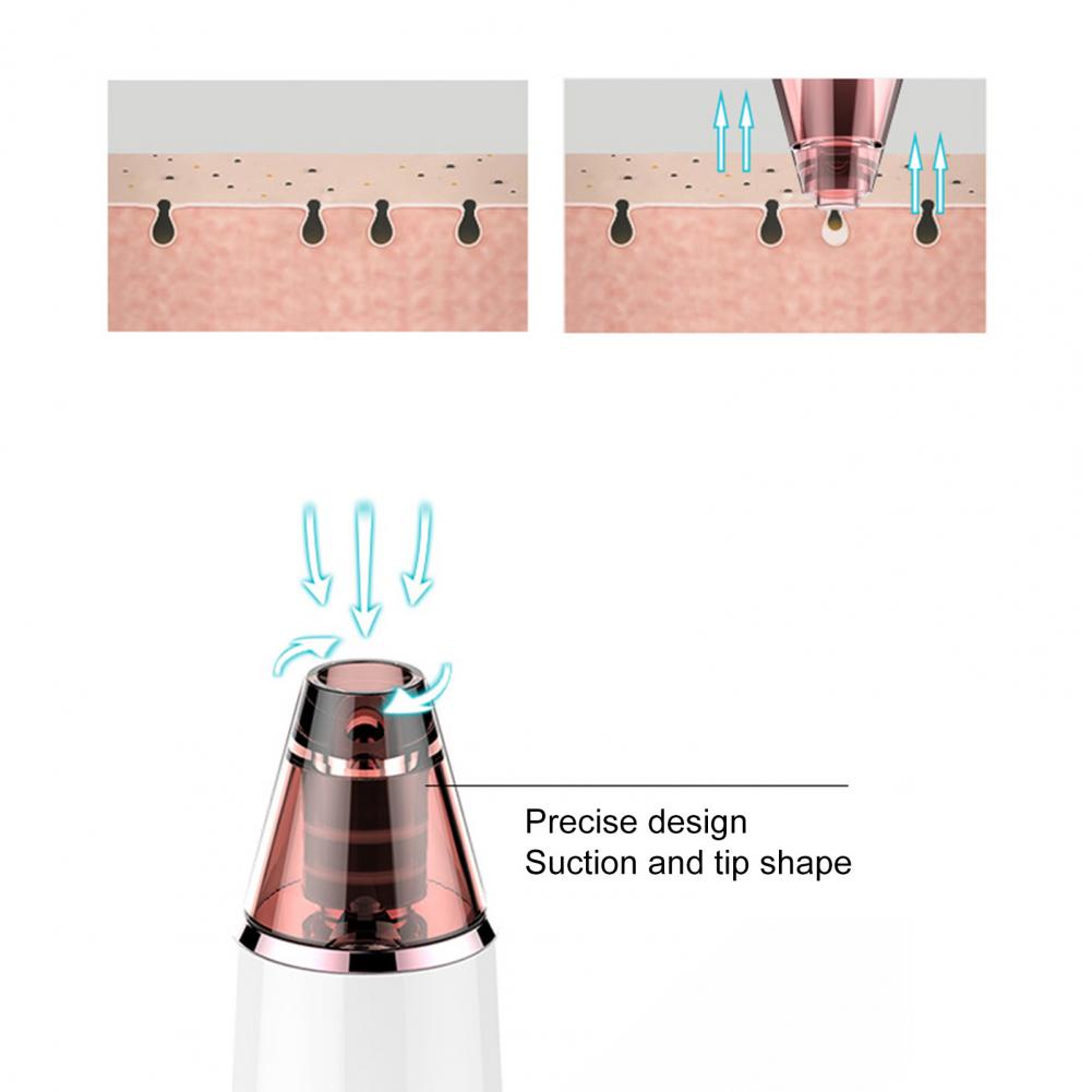 Acne%20Remover%20Good%20Grip%20USB%20Charging%20Multipurpose%20Electric%20Comedone%20Extractor%20Tool%20%20%20Blackhead%20Vacuum%20%20for%20Unisex%20-%20Image%205