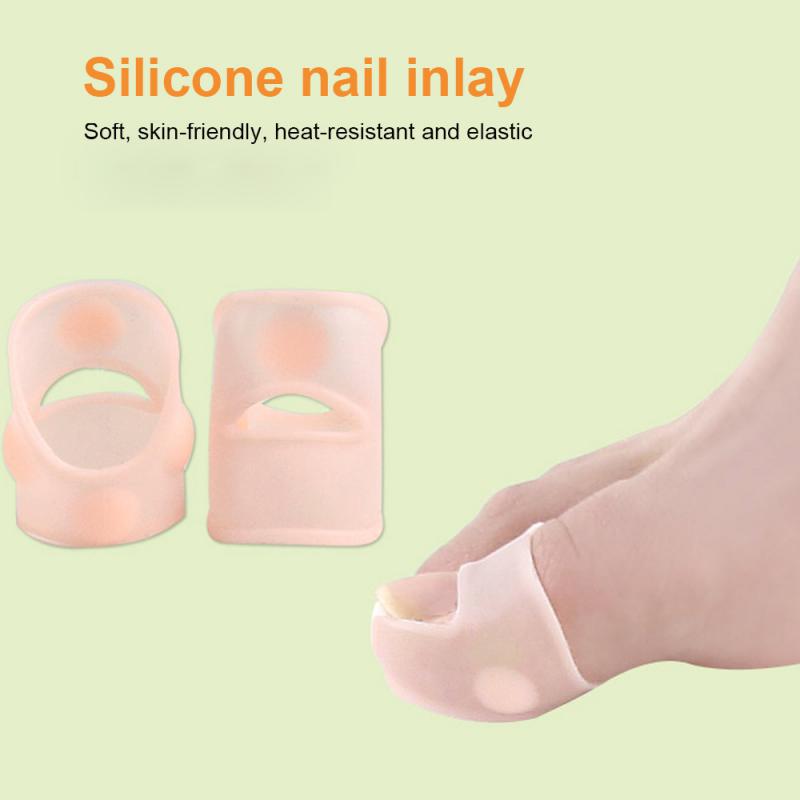Wenefang%20Fashion%201/3/5PCS%20Ingrown%20Toe%20Nail%20Correction%20Tool%20Toenail%20Straightening%20Tool%20Repair%20Kit%20Patch%20Correctors%20Nail%20Care%20Orthosis%20Foot%20Tool%20-%20Image%203
