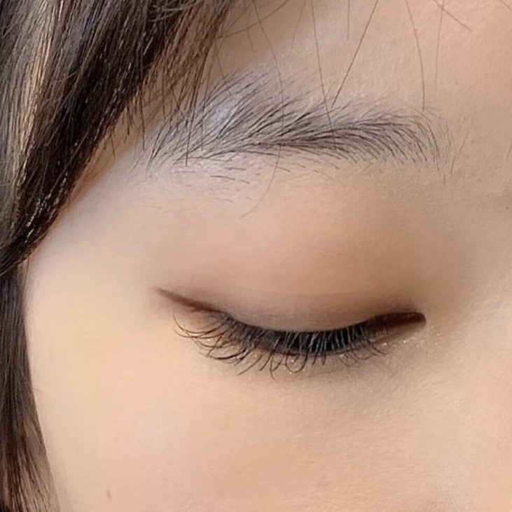 Kích Mí, Dán Kích Mí Trong Suốt Siêu Tàn Hình