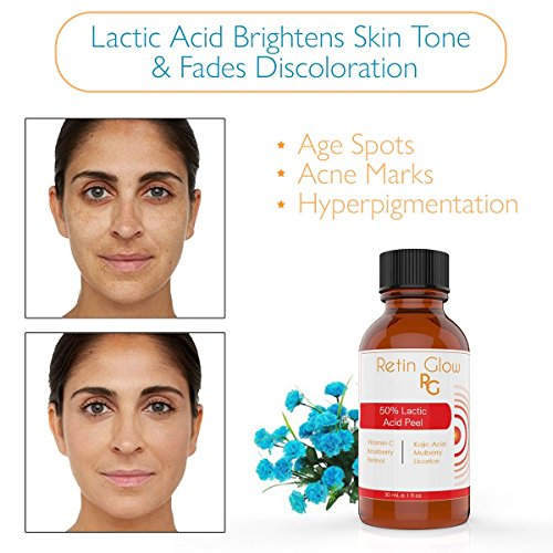retin glow intense fade cream