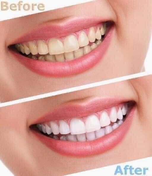 Kem đánh răng nhân sâm thảo dược Ryo 1 tuyp