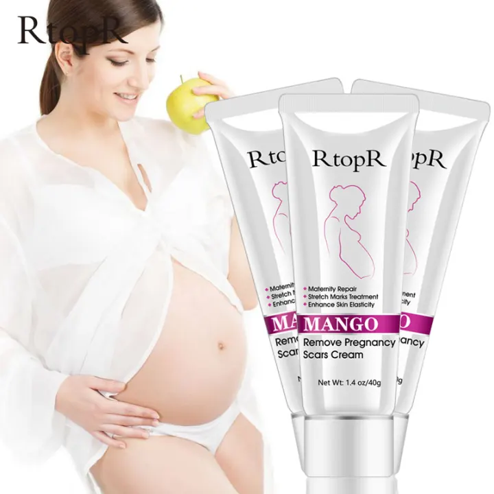 rtopr stretch mark cream