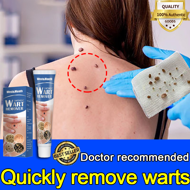 Wart Removal Ointment Fast Remove Skin Tag Remover Original Ointment