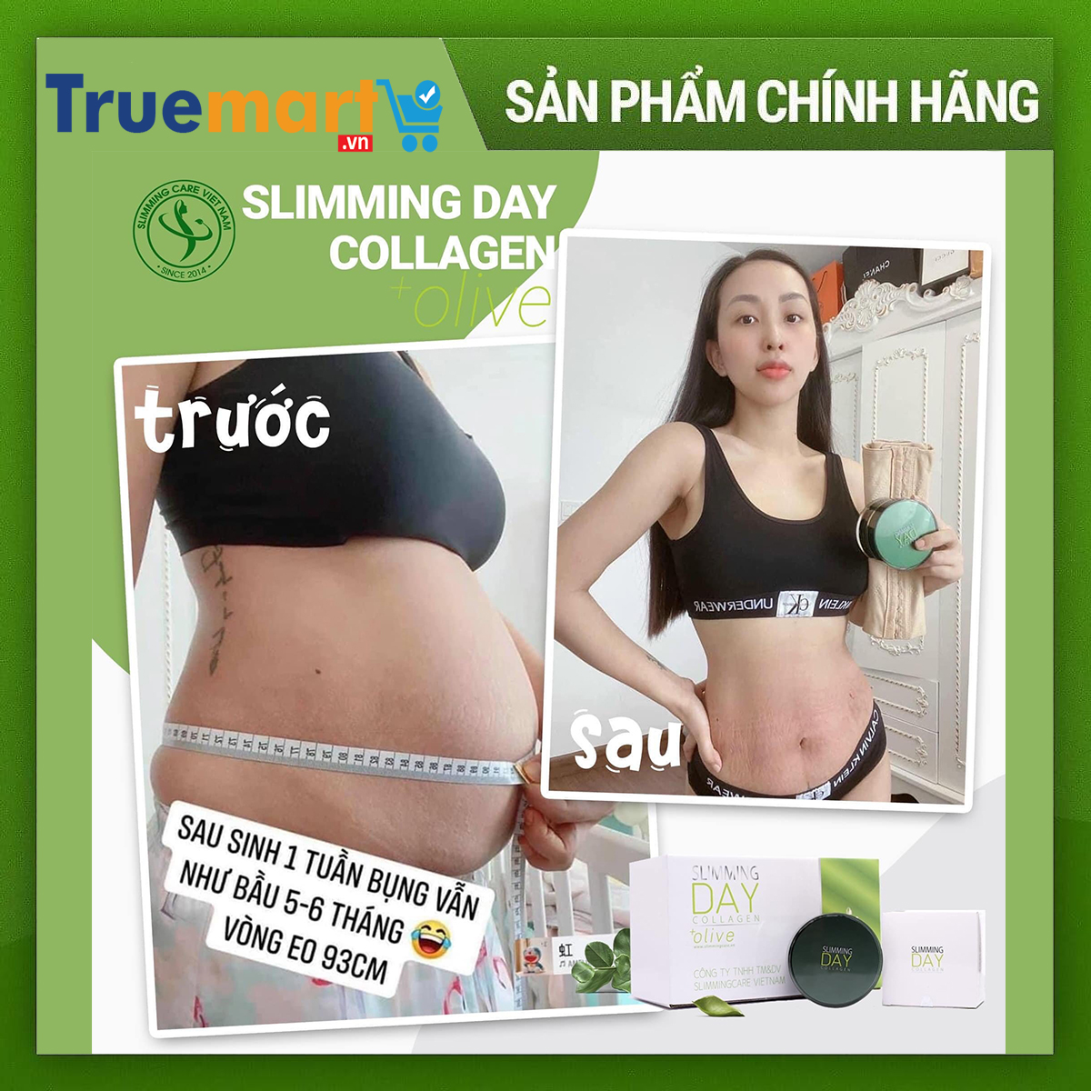 Bộ đai định hình tan mỡ, mờ rạn Slimming day collagen (SDC)
