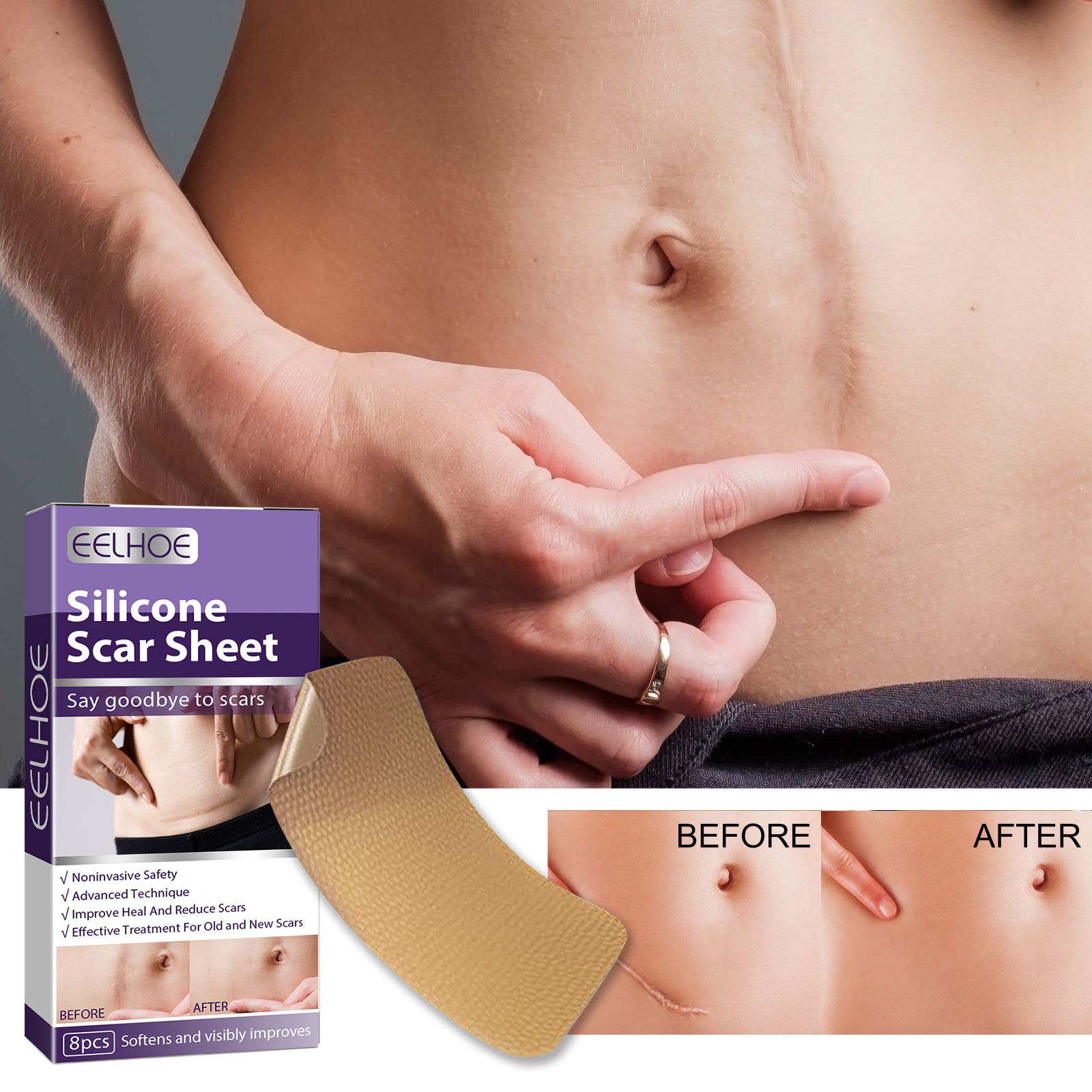 Scar%20Treatment%20Silicone%20Gel%20Sheet%20Eliminate%20Stretch%20Mark%20Scald%20Burn%20Scar%20Removal%20Acne%20Trauma%20Skin%20Repair%20Fade%20Surgery%20Scar%20Patch%20-%20Image%209