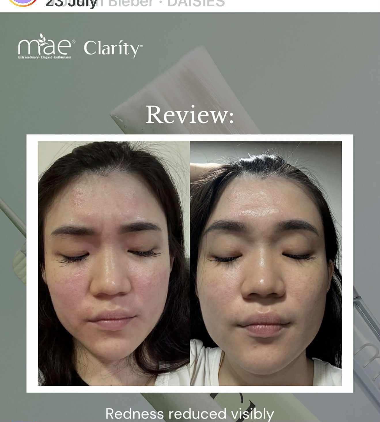 Mint Mask MAE Clarity Mint Mask 14 Sachets Barley Glass and Spirulina For a  Boost of Elasticity and Radiance | Lazada Singapore