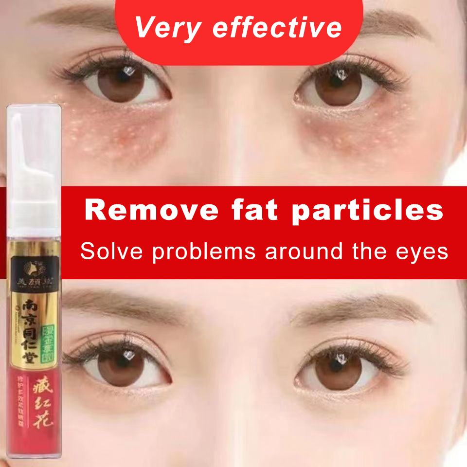 Milia Remover Cream Original 20ml Eye Bag Remover Original Butlig Sa