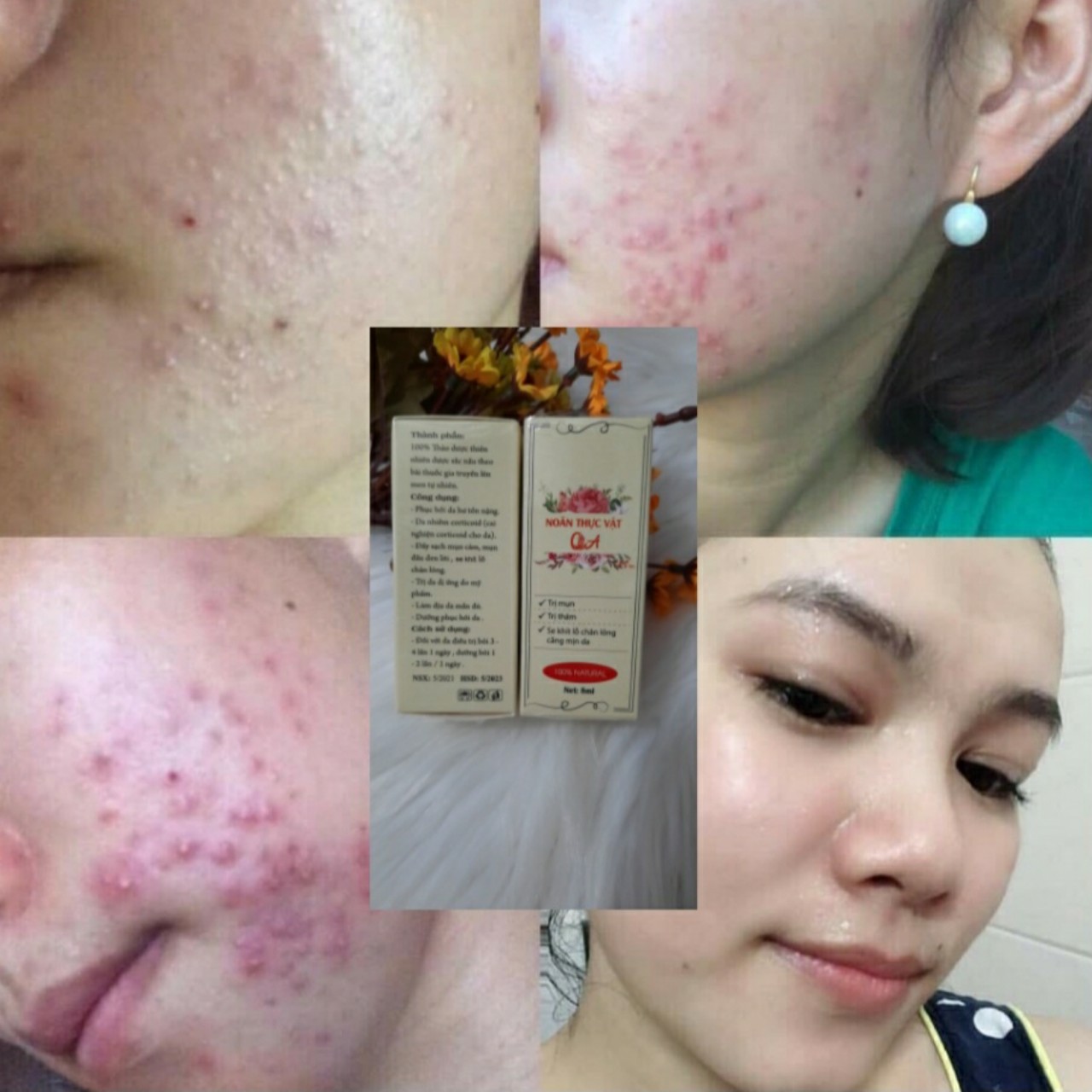 Noãn thực vật QA beauty spa
