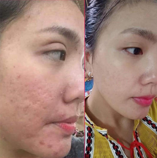 Ủ Trắng Abutine 3C 350ml Chăm Sóc Da Hoàn Hảo - Mẫu mới