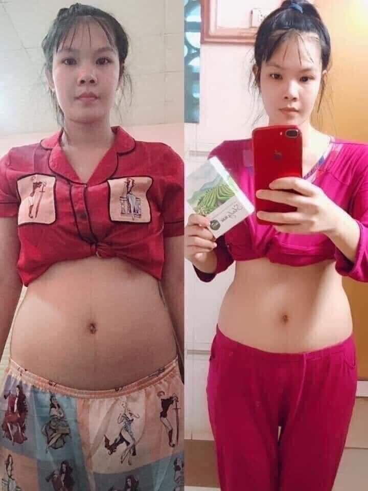 [HCM]Nấm giảm cân viên slim sbody