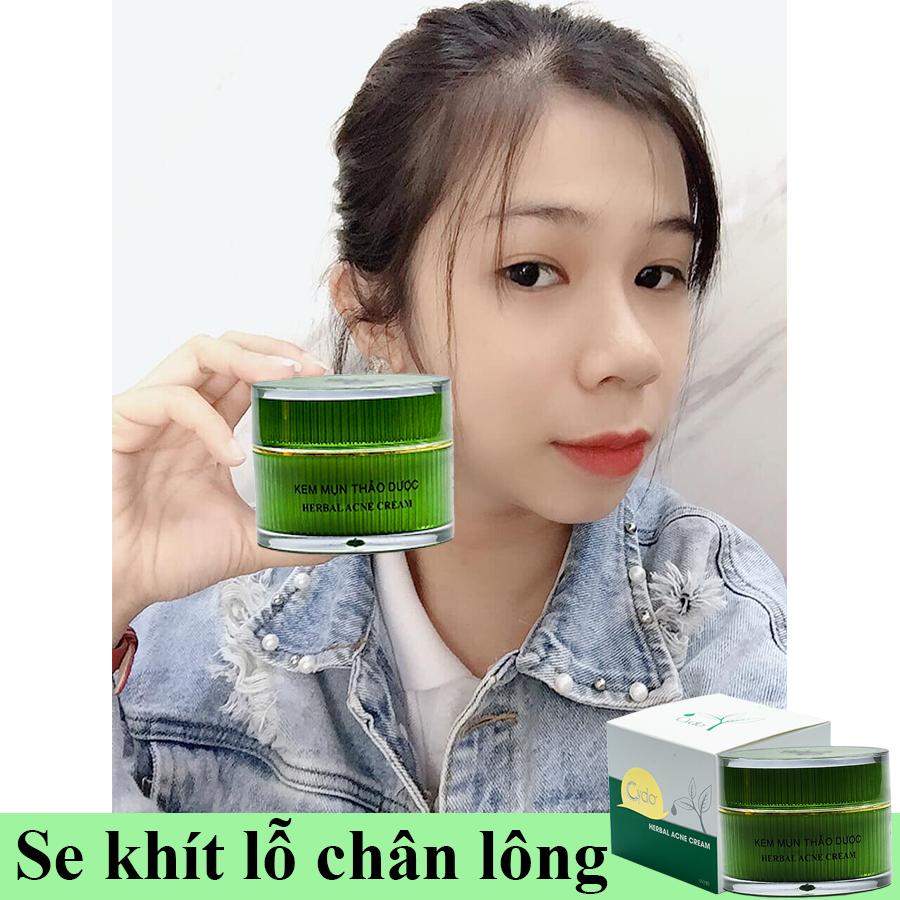 KEM MỤN THẢO DƯỢC CYDO